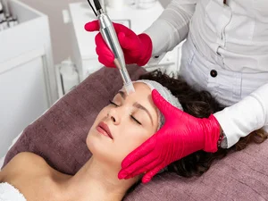 Benefits of Microneedling at Embrace Med Spa in Torrance CA