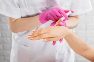 PRP Hand Rejuvenation by Embrace Med Spa in Torrance CA