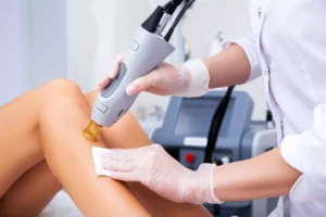 Laser Hair Removal Treatment by Embrace Med Spa in Torrance CA