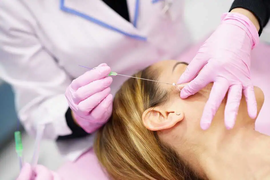 PDO Threads Treatment in Torrance, CA by Embrace Med Spa